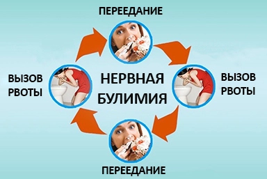 Лечение булимии в Эльбане